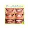 Freshmile Tiras Blanqueadoras Dentales Sensibles