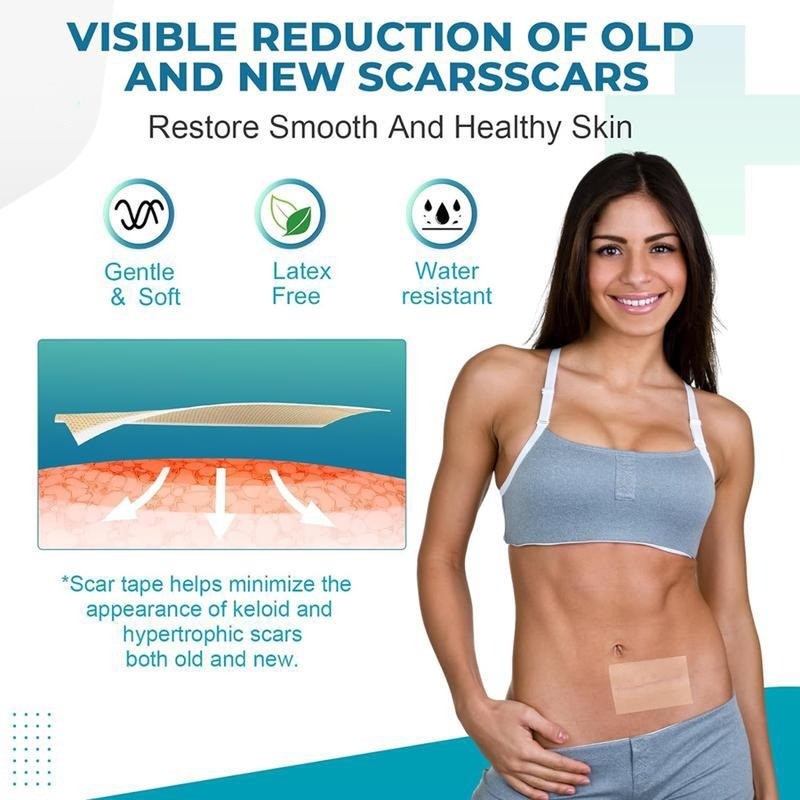 Professional Silicone Scar Sheets – Reusable Tape Strips for Keloid,