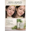 Bioaqua Suero Facial Centella Asiatica Antiacne Y Reparador