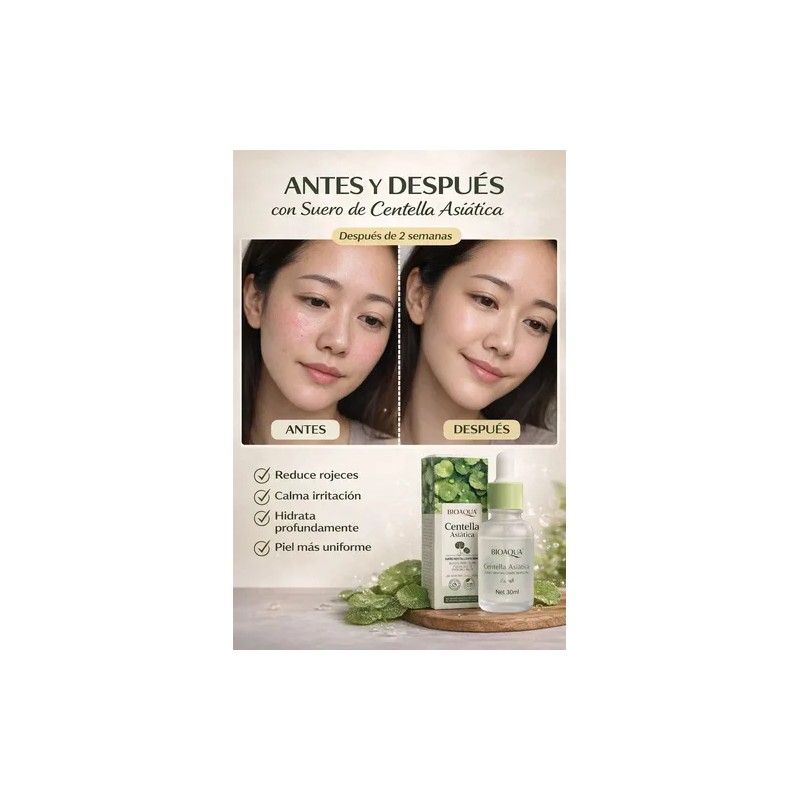 Bioaqua Suero Facial Centella Asiatica Antiacne Y Reparador