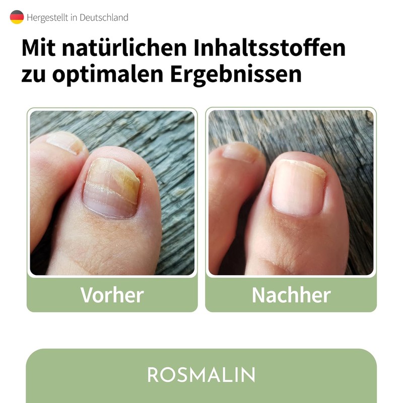 Nail Care Pen – Particularly Effective – From Germany –