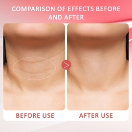 Glossy Smoothing Body Serum 100ml – Firming & Hydrating Skin Treatment with Hyaluronic Acid, Peptides & Panthenol – Reduces Wrinkles & Fine Lines for Arms, Legs, Neck, and More