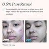 MDacne – Retinol 0.5% and Niacinamide 4% Cream, Reduces Blemishes