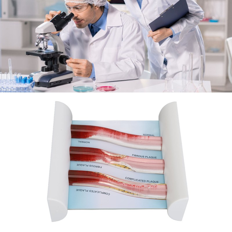 Lipoprotein LDL Blood Vessel Model Low Density Blood Lipid Vessel