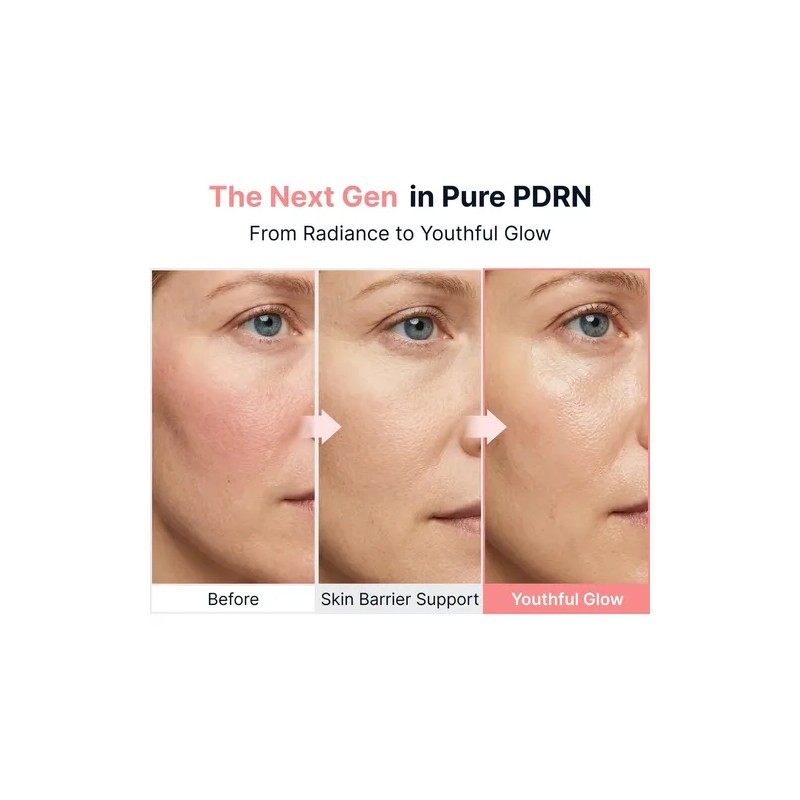 Sérum Facial Antiedad Coreano,deep Collagen Peptide Intensi
