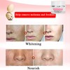 Face Whitening Brightening Cream Freckle Removal Skin Moisturizing Nourishing Cream