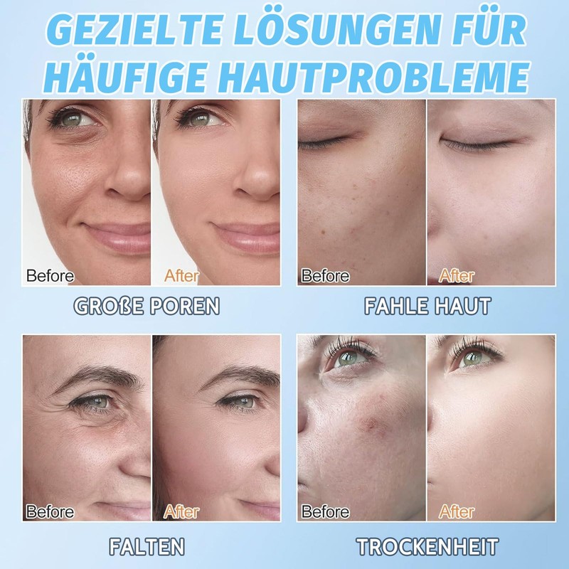 Altherona Collagen Maske 4 Stück, Gesichtsmaske Skin Care Korean, Kollagen