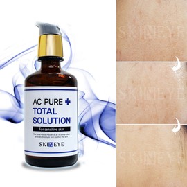 Skin Eye [72 Hour Chance] AC Pure Total Solution Sensitive Skin Soothing All-in-One Lotion for Men