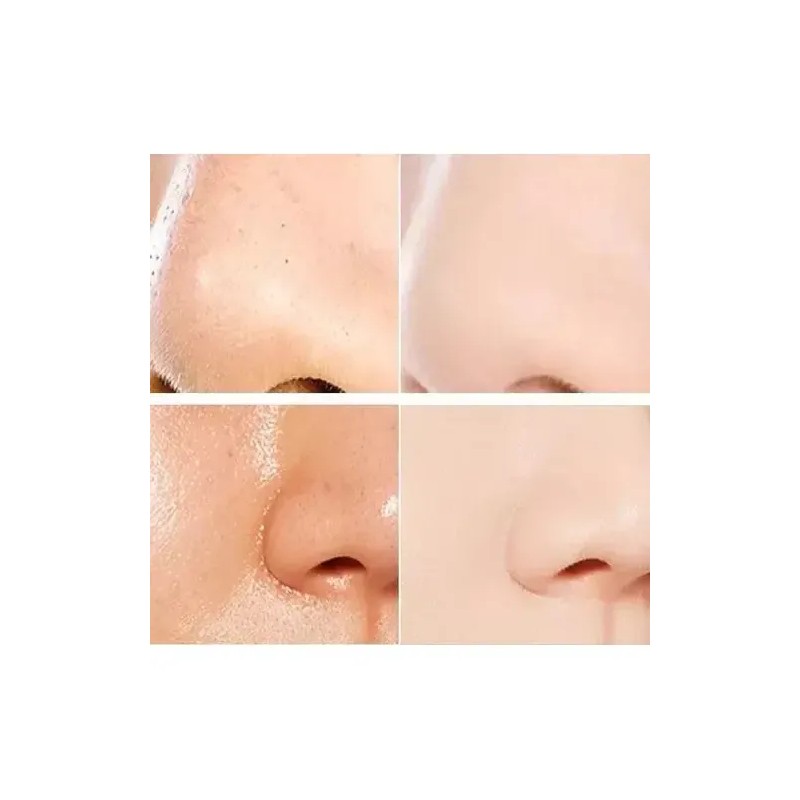 3 Mascarillas Faciales Green Stick Originales Que Eliminan P