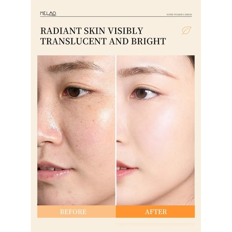 Sérum Facial Vitamina C Brillo Hidratante 30ml