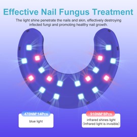 2nd Generation Nail Fungus Light Tool for Multiple Toenails and Fingernails Nail Repair Solution for Damaged and Discolored Nails Portable for Travel or Home Use