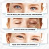 Under Eye Patches for Puffy Eyes, Dark Circles, Dull Skin