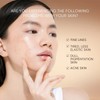 SKINTIFIC Retinol Anti-Aging Serum – Brightening & Dark Spot Correcting