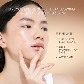 SKINTIFIC Retinol Anti-Aging Serum – Brightening & Dark Spot Correcting Night Serum for Skin Renewal and Fine Line Reduction