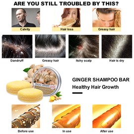 2PCS Ginger Hair Regrowth Shampoo Bar, Anti Hair Loss Ginger Shampoo Soap, Promotes Hair Growth, Hair Growth Repair