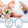Aromixe Foot Sanitizer Spray 120ml – Antimicrobial with Tea Tree