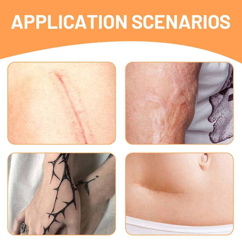 Leogony 12 Pcs Waterproof Cover Up Patch, Invisible Breathable Long