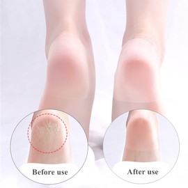 10 Pcs Moisture Heel Stickers Invisible Anti Wear Foot Sticker Breathable Cushion Blister Guard Patch for Moisturizing Cracked Dry Foot Plantar Fasciitis