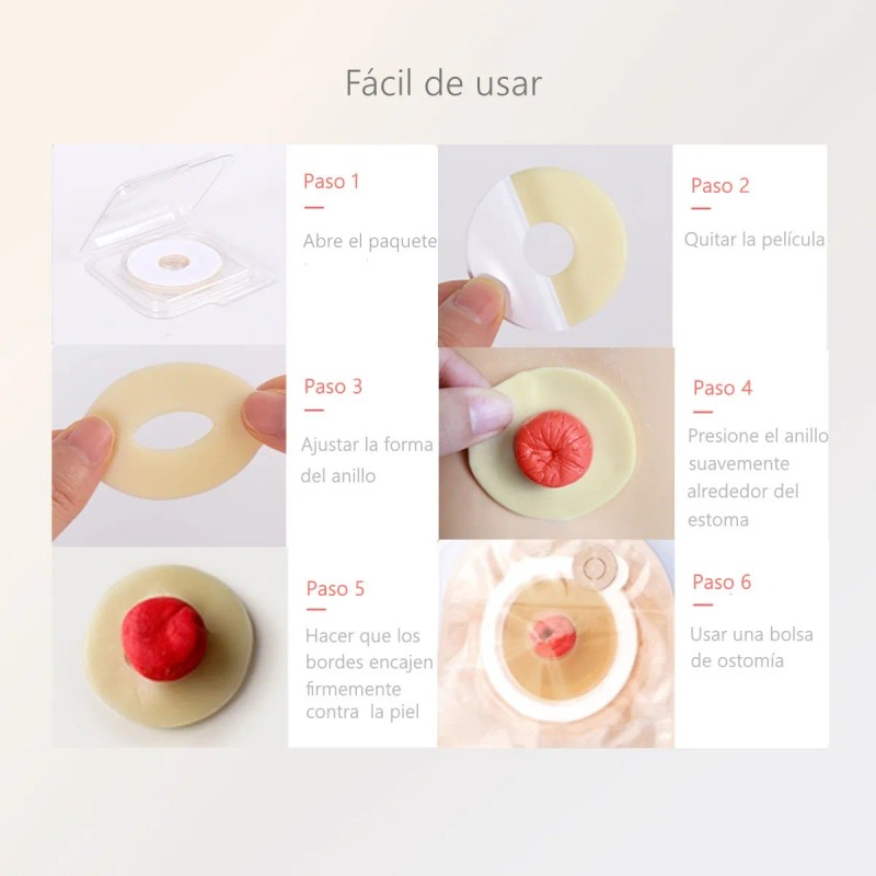 Anillo Barrera Para Ostomía 50mm 10pzas