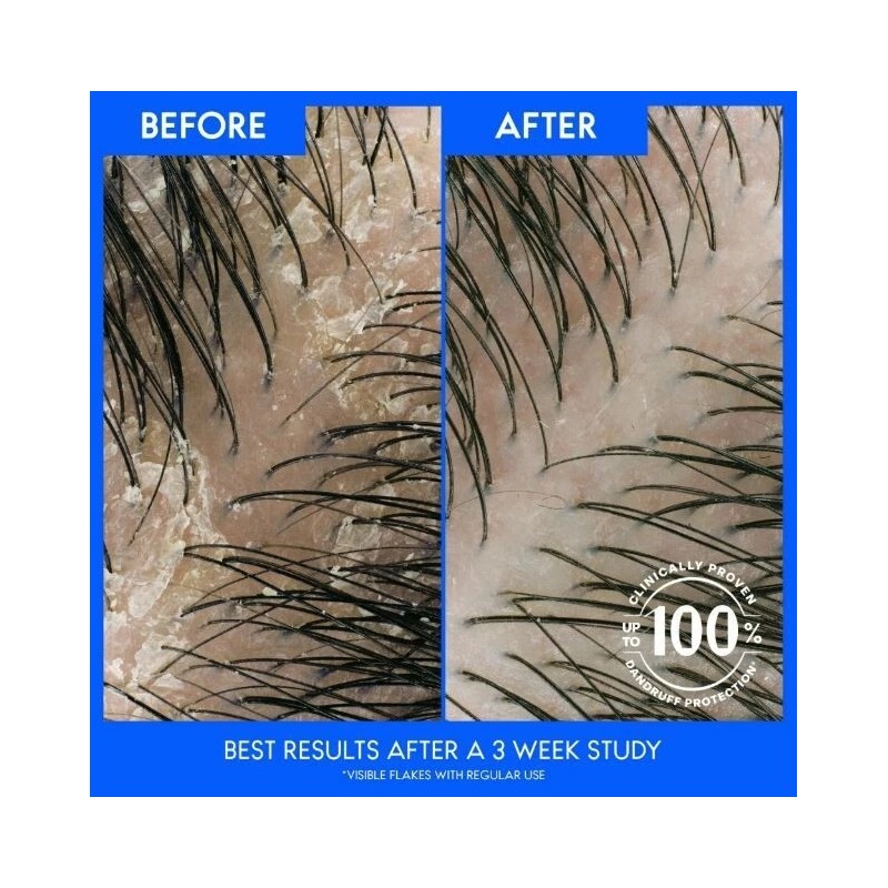 Head and Shoulders Dandruff Shampoo, Aloe Vera for Soothing Scalp