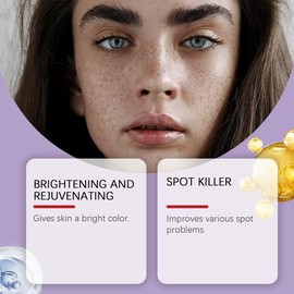 H-yperpigmentation Cream， Advanced Anti-Hyperpigmentation C-ream, Hyperpigmentation Treatment Cream， for Dark Spots, Age Spots, Sun Spots - Anti-Aging & Skin Firming Face Cream for All Skin Types