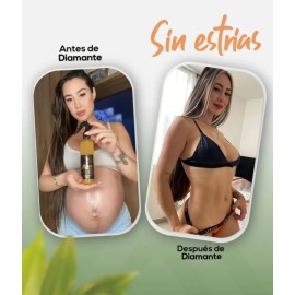 Aceite Puro Colágeno Elastina Reduce Y Evita Estrías Neutra