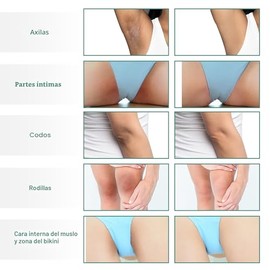 Crema de Blanqueamiento de la Piel Vcetree para Áreas Íntimas del Cuerpo, Partes Privadas, Axilas, Rodillas, Codos, Parte Interna de los Muslos, Área 