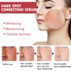 2pcs Dark Spot Correcting Serum with Niacinamide Hyperpigmentation Even Skin