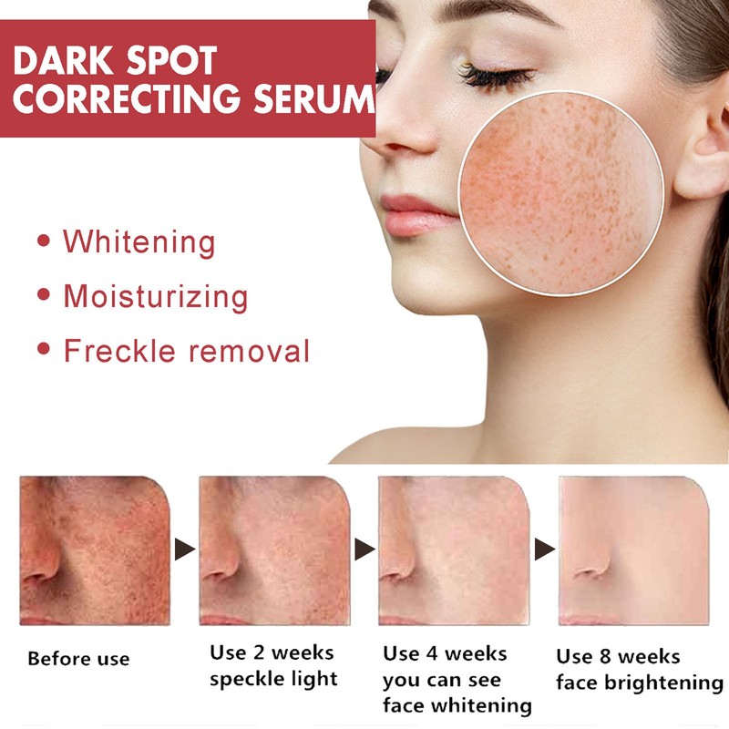 2pcs Dark Spot Correcting Serum with Niacinamide Hyperpigmentation Even Skin