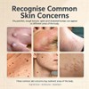 Eczema Cream 20g，Soothes Itchy, Gentle and Relieves Itching, for Dermatitis