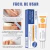 Pomada Antifúngica Para Uñas 30g,tratamiento Contra Hongos