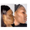 Turmeric Serum, Dark Spot Remover, Flawless Face Serum, Even Glowing