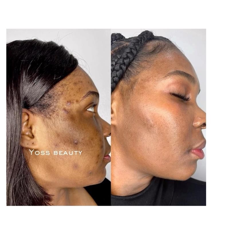 Turmeric Serum, Dark Spot Remover, Flawless Face Serum, Even Glowing