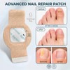 Toenail Care Patches, 21 PCS Overnight Nail Wraps for thick