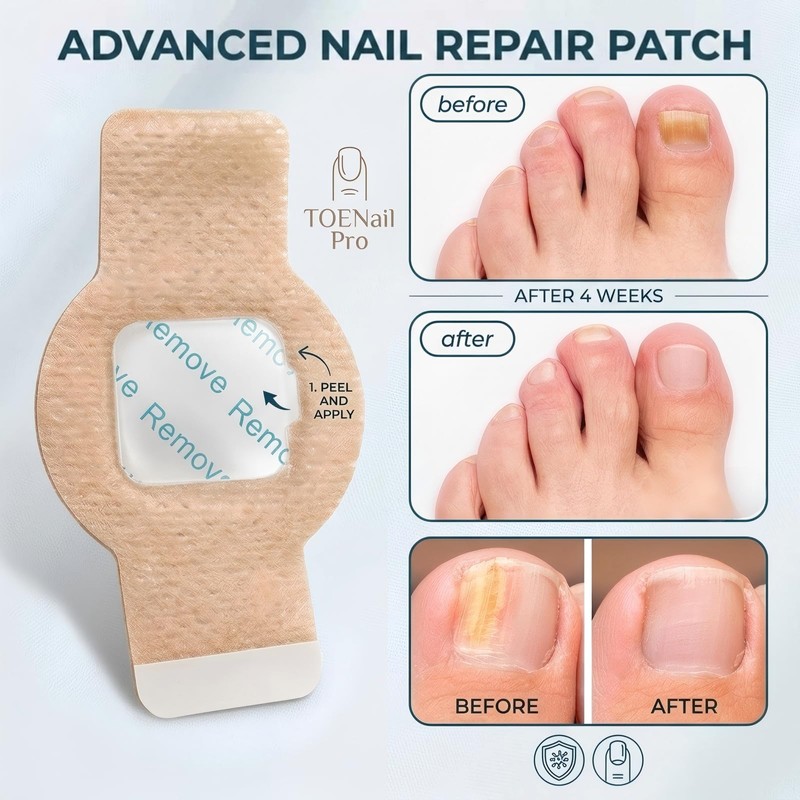 Toenail Care Patches, 21 PCS Overnight Nail Wraps for thick