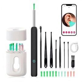 SpringBreak Earwax Removal Tool Set with Camera - Portable 360¬∞ Wide Angle Ear Cleaner with Type-C Rechargeable, Waterproof Endoscope Ear Cleaning Tool for iPhone and Android Phones, Christmas Gift, Winter Gift Set, New Year Gift, Stocking Fillers:_White Pro