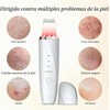 Peeling Ultrasónico Facial LOTOVERDE con 4 Modos y Limpieza Profunda