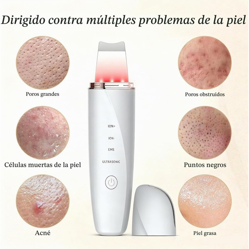 Peeling Ultrasónico Facial LOTOVERDE con 4 Modos y Limpieza Profunda