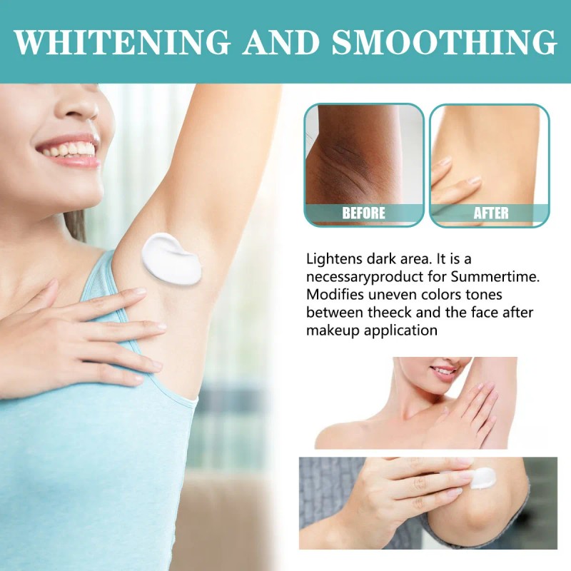 Q Crema Reparadora De Manchas Oscuras J Crema Para Axilas