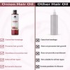 Gamium Gamium Advanced Onion Hair Oil for Hair Growth and