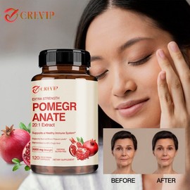 Highly concentrated pomegranate extract, 40% ellagic acid, antioxidant effect, immune support, platelet health, 3 pieces, 120 tablets / 고농축 석류 추출물 엘라직애씨드 40% 함유 항산화 효과 면역력 지원 혈소판 건강, 3개, 120정