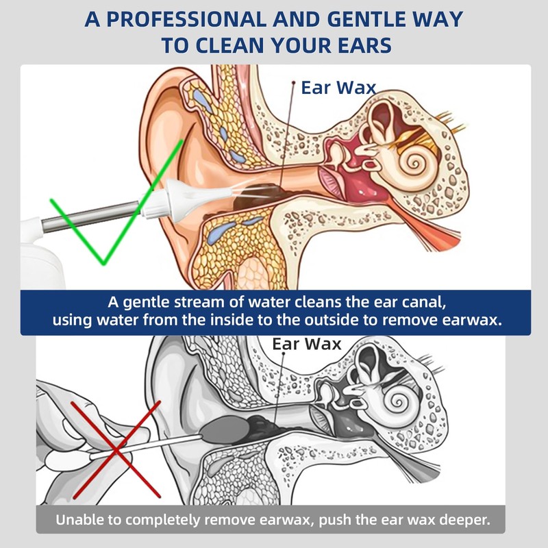 Electric Ear Wax Removal Water Powered Ear Cleaner with 6