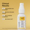 CLEARSTEM - CLEARITY The Blackhead Dissolver Mandelic Acid Serum -