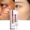 Effective Whitening Freckle Cream Remove Dark Spot Cream Removal Melanin
