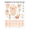 Disorders of the Teeth and Jaw Anatomical Chart 20" X