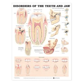 Disorders of the Teeth and Jaw Anatomical Chart 20" X 26"