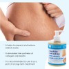 SODERMOL Anti-Stretch Mark Cream Ideal for Pregnancy/Prevents and Reduces The