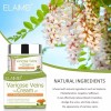 Purvigor Crema Para Eliminar Rápido Las Varices Y Arañitas Vasculares