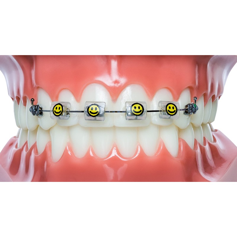 Snapcaps Braces Bumper Cover, Orthodontic Bracket Wax Substitute, Alternative Snap-on