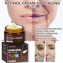 Retinol Anti-Aging Wrinkle Removal Skin Firming Cream - Face Revitalizing Cream & Essence, Brightening Moisturizing, Facial Massager Skin Tightening, Wrinkle Remover Instant